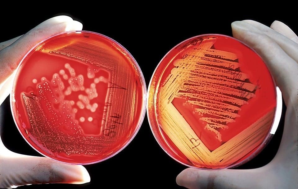 Bacteria Test